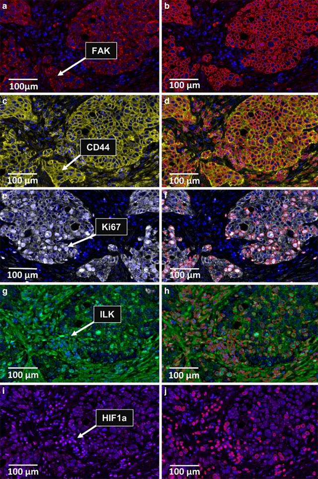 Multiplex immunofluorescence